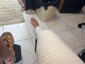 Immobile for three weeks.