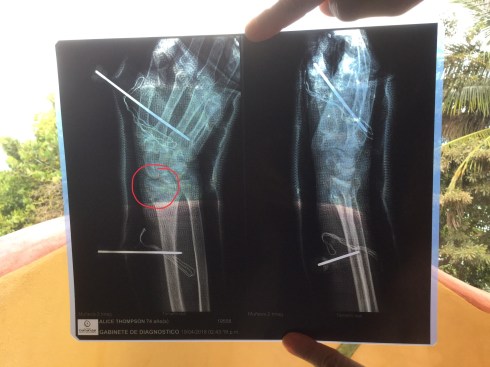 1C4FFD55-AFEE-40BE-990A-AB26A7C3ECE7