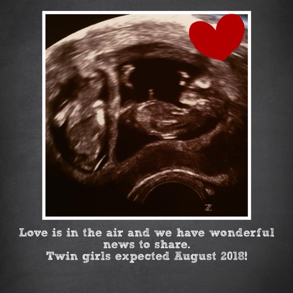 3D2F74A8-3846-45F6-AFA8-2EB2603102B0